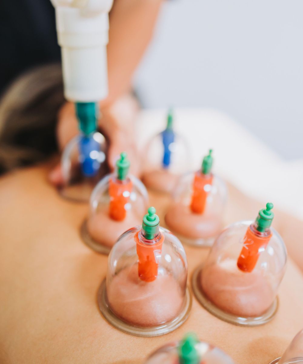 Suction Cups Placed on a Female Patient's Back, by a Massage Therapist. Medical Spa Massage Center.